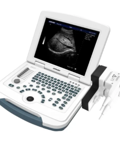 Portable Ultrasound Scanner