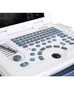 Alternative view of Portable Ultrasound Scanner