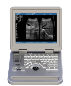 Alternative view of LCD Digital Ultrasound Scanner